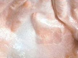 Los científicos australianos están desarrollando un tipo de tejido sintético con nervios y vasos sanguíneos. ESPECIAL  /