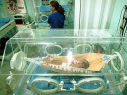 El bebé nació este sábado producto de una madre diabética, dependiente de insulina. ESPECIAL  /