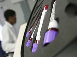 Las células madre son las células maestras del cuerpo. ESPECIAL  /