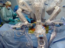 ''Mano Pequeña A'' es capaz de hacer movimientos y curvas en 360 grados. EFE  /