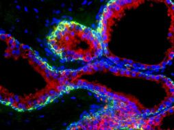 Se buscarán nuevos indicadores de la enfermedad en las células basales. ELMUNDO.ES  /