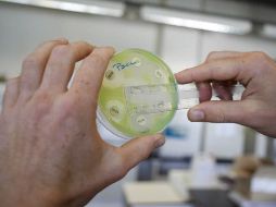 El NDM-1 se encuentra en el plásmido, unas estructuras de ADN que se transfieren fácilmente entre bacterias. AFP  /
