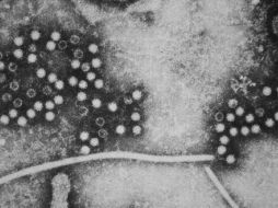 Se estima que el virus ha infectado a un tercio de la población mundial. ESPECIAL  /