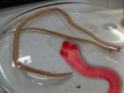 Existe una variedad de parásitos que se alojan en alguna parte del sistema digestivo de los individuos. Agencia ID  /