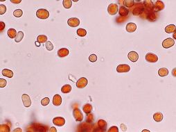 Las células rojas se están reproduciendo a temperaturas de 121 grados centígrados. ESPECIAL  /