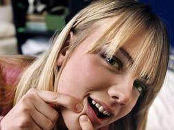 Según estudios existe una relación sólida entre el acné y los síntomas de depresión u otros problemas de salud mental. ESPECIAL  /