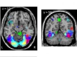 Las zonas del cerebro especializadas en el vocabulario y en el reconocimiento visual, funcionan también en la alfabetizació. ELPAIS.COM  /