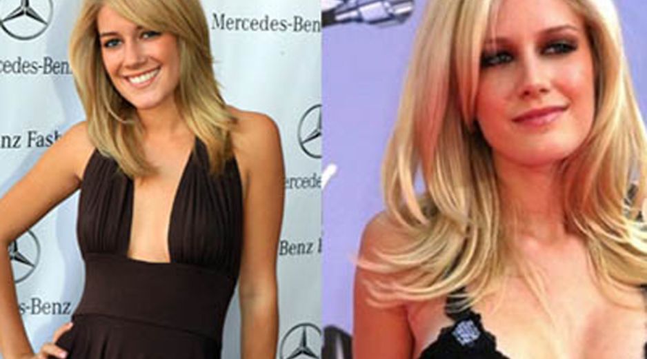 Montag dice que zonas de su cuerpo lucen peor que antes de la cirugía. ESPECIAL  /