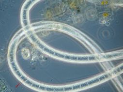 La Pseudomonas aeruginosa pueden coexistir como un microbio benigno en personas sanas. EFE  /