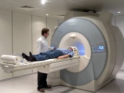 La nueva tecnología de resonancia magnética agiliza la obtención de las imágenes cerebrales respecto a otras técnicas. EFE  /