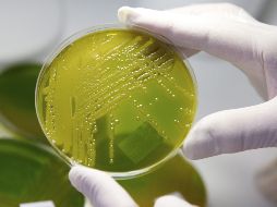 Un empleado de un laboratorio comprueba muestras de bacteria E. coli Enterohemorrágica. EFE  /