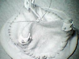 Las nuevas válvulas artificiales constarán de un anillo metálico discontinuo que amortigüe la fuerza de la sangre. ID  /