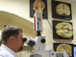 Según el equipo de expertos, los casos de demencia se incrementan de forma ‘excepcional’ con la edad. EFE  /