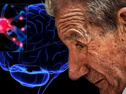 En etapas tempranas es poco probable diagnosticar la enfermedad. ID  /