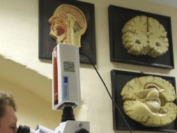 El EVC provoca daños severos, irreversibles y mortales. EFE  /