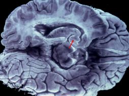 Científicos buscan nuevas formas de detener el avance de la demencia en la población. EFE  /