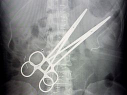 El médico que olvidó las pinzas fue denunciado por lesiones gravísimas y debilidad permanente a la mujer. EFE  /