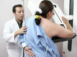 Los problemas de cáncer más comunes en la mujer son los mamarios. ARCHIVO  /