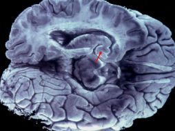 El estudio da una luz sobre cómo funciona la sinapsis. ARCHIVO  /