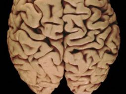 La iniciativa cuenta con la estructura y los recursos humanos y técnicos del Blue Brain Project. ARCHIVO  /