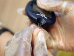 Es importante mantener los niveles de azúcar en la sangre en un nivel estable. ARCHIVO  /