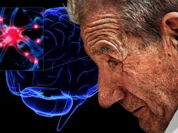 El modelo que se ha utilizado desde 1960 sólo contempla la presencia de lesiones en el mesencéfalo. ESPECIAL ID I  /