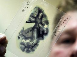 Cuando aparecen las primeras señales de acumulación de placa en el cerebro ocurren trastornos en el ciclo normal de sueño. ARCHIVO  /