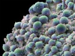 Las células con resistencia a la quimioterapia podrían ser el talón de Aquiles del cáncer. ESPECIAL  /