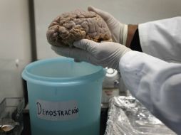 A pesar de las diferencias en personalidad y habilidades cognitivas, los cerebros humanos son más parecidos de lo pensado. ARCHIVO  /
