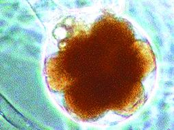 El microorganismo Serratia liquifaciens se halla en la piel humana. REUTERS /