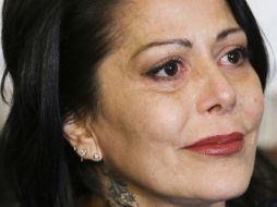 A la cantante le practicaron una artroplastía debido a que la cabeza del fémur izquierdo estaba muy desgastada. ARCHIVO /