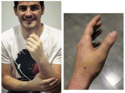 La lesión le tendrá de baja al portero merengue unos tres meses EFE /