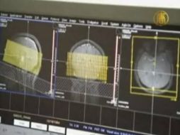 Prevén que en los próximos años el avance pueda desarrollar los primeros objetivos sovre el dolor. ARCHIVO /