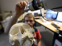 Las operaciones con el robot son similares a la laparoscopia, en que se usan instrumentos diminutos, introducidos en el cuerpo. ARCHIVO /