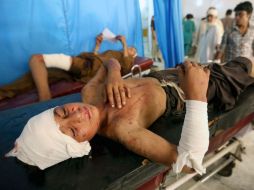 Pequeños son atendidos tras la explosión de una bomba seguida de tiroteos cerca de Pesháwar. EFE /