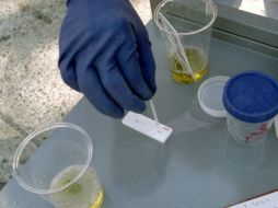 El nuevo instrumento, llamado ODOREADER, contiene un sensor que responde a los gases de la orina. ARCHIVO /