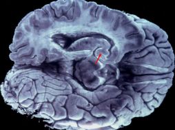 El cerebro aún guarda muchos secretos, así lo han demostrado estudios recientes. ARCHIVO /