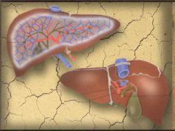 La hepatitis c provoca al menos 15 mil muertes al año en los Estados Unidos. ARCHIVO /