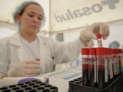 Este trabajo permite obtener una visión más completa de los genes humanos y la resistencia inmune al VIH. ARCHIVO /