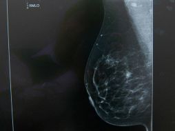 Con cierta concentración de nanopartículas de plata muere 80 por ciento de las células cancerígenas. ARCHIVO /