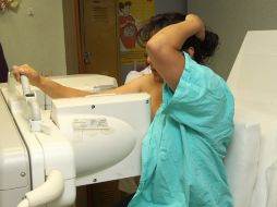 Conforme avanza en edad, la mujer debe practicarse mamografías periódicamente. ARCHIVO /