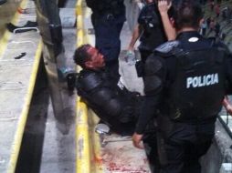 El usuario de Twitter @SergioTabares_  captó el resultado de la agresión a los policías al final del Clásico Tapatío. ESPECIAL /