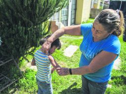 Marta Serratos muestra el brazo derecho de su nieta, quien presenta una infección por el ambiente insalubre que la rodea en La Azucena.  /