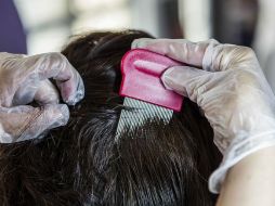 Cuando ya hay infestación, la erradicación de los piojos puede ser muy difícil, y costosa. ARCHIVO /