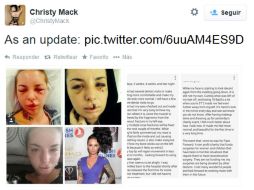 El rostro de Christy sólo requirió de pocas cirugías para reparar el daño que provocó el apodado 'War Machine'. TWITTER @ChristyMack  /