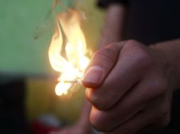 El responsable del área municipal de prevención del delito, resulta con diversas quemaduras provocadas por el manejo de gasolina. EL INFORMADOR /