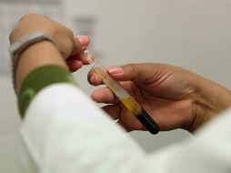 Enfermedades como la leucemia, el linfoma  y otros padecimientos de la sangre se vuelven más comunes con la edad. SUN / ARCHIVO.