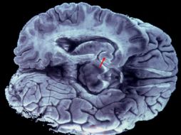 Uno de los órganos presumiblemente pertenece al asesino múltiple Charles Whitman. EFE / ARCHIVO