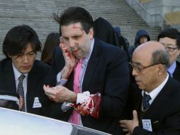 La televisión surcoreana muestra una foto de Lippert tras el ataque, diciendo que las lesiones no ponen en riesgo su vida. AP / K. Ju-Sung