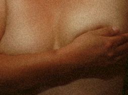 No se trata de un proceso cosmético, pero se cumple la función estética en estas pacientes. EL INFORMADOR / ARCHIVO